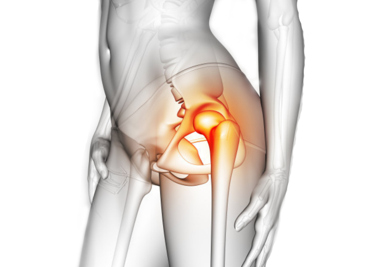 ТАЗОБЕДРЕННЫЙ СУСТАВ